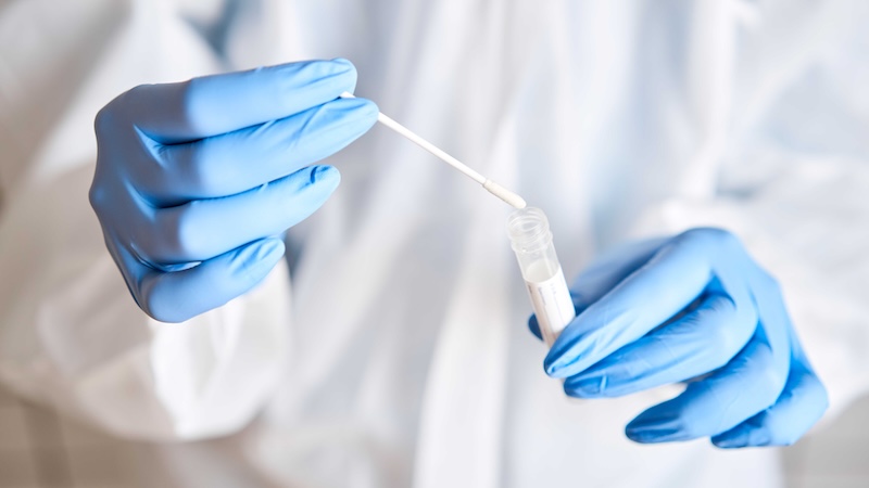 Saliva Test Results